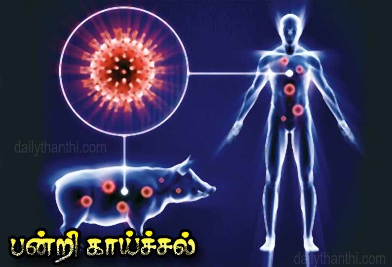 மேட்டுப்பாளையம் தம்பதிக்கு பன்றிக்காய்ச்சல் பாதிப்பு - கோவை அரசு ஆஸ்பத்திரியில் தீவிர சிகிச்சை