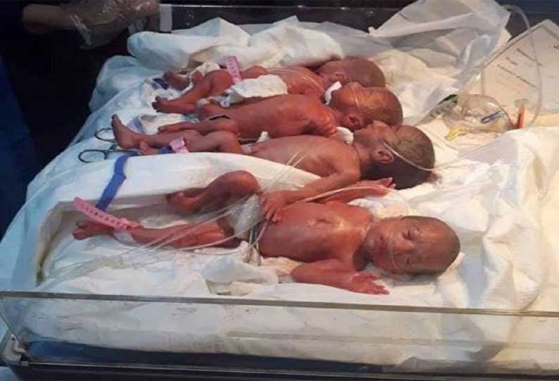 உலகில் 2-வது முறையாக ஒரே பிரசவத்தில் 7 குழந்தைகள் பிறந்தன