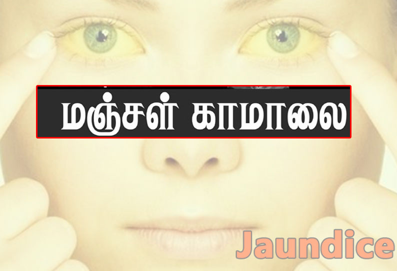 அரசு மருத்துவக்கல்லூரியில் மஞ்சள் காமாலை நோய் தின விழிப்புணர்வு கருத்தரங்கம்