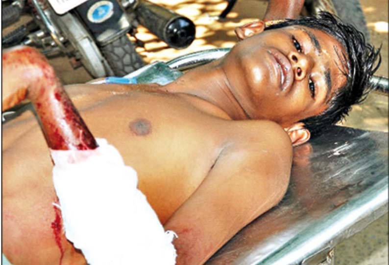 போலீஸ் நிலையத்தில் ஆஜராகி விட்டு வந்த வாலிபருக்கு அரிவாள் வெட்டு - 2 பேர் சரண்