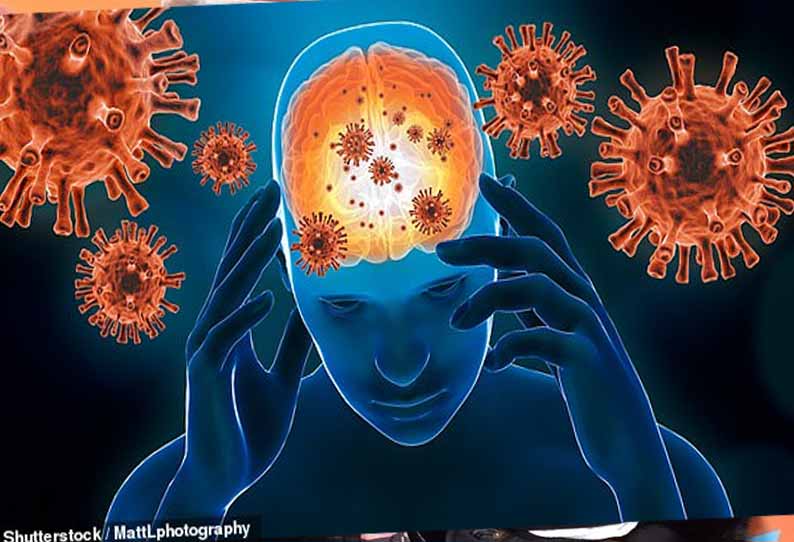 கொரோனா தொற்றின்  லேசான பாதிப்பு கூட மூளை பாதிப்புகளை ஏற்படுத்தும் - விஞ்ஞானிகள் எச்சரிக்கை