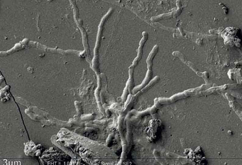 2,000 ஆண்டுகளுக்கு முன்பு எரிமலை வெடிப்பால் மரணமடைந்த மனிதனின் மூளை செல்கள் கண்டுபிடிப்பு