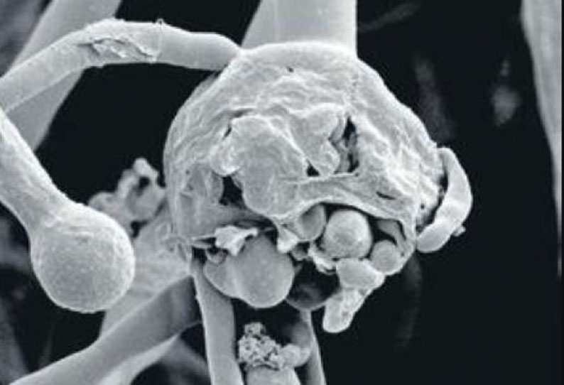 கேரளா மாநிலத்தில் கருப்பு பூஞ்சை நோய் காரணமாக இளம் பெண் உயிரிழப்பு