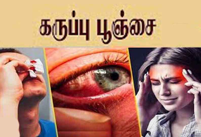 சேலம் மாவட்டத்தில் இதுவரை கருப்பு பூஞ்சைக்கு 473 பேர் பாதிப்பு