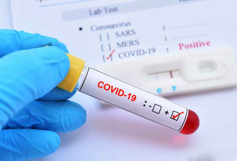 202109031025596362_Namakkal-Corona-infection-confirmed-for-10th-class-student_SECVPF