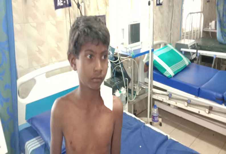 வால்பாறையில் பட்டப்பகலில் வீட்டின் முன்பு விளையாடிக்கொண்டிருந்தபோது சிறுத்தை தாக்கியதில் வடமாநில சிறுவன் படுகாயம் அடைந்தான்.