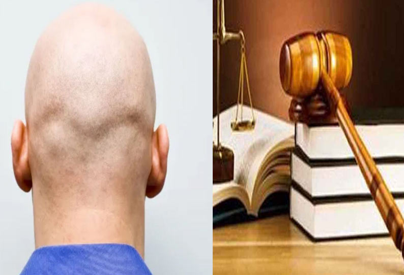 Calling Man Bald At Work Is Sexual Harassment Rules Uk Tribunal பணியிடங்களில் ஆண்களின் 